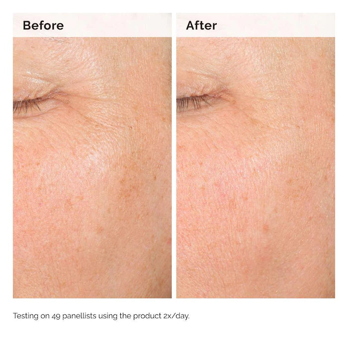 The Ordinary Alpha Arbutin 2% + HA Hyperpigmentation Serum