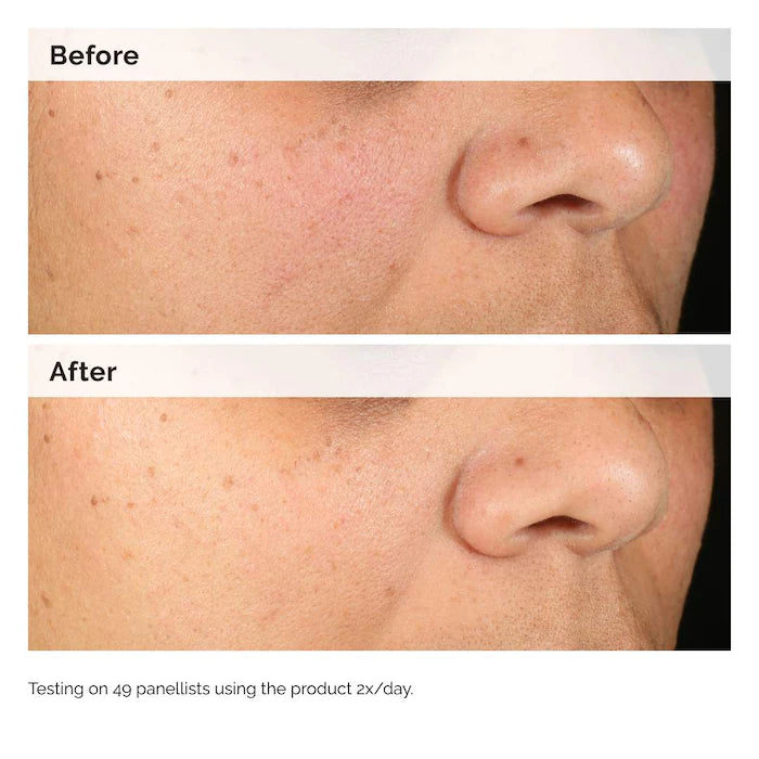 The Ordinary Alpha Arbutin 2% + HA Hyperpigmentation Serum