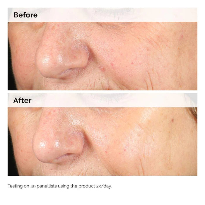 The Ordinary Alpha Arbutin 2% + HA Hyperpigmentation Serum