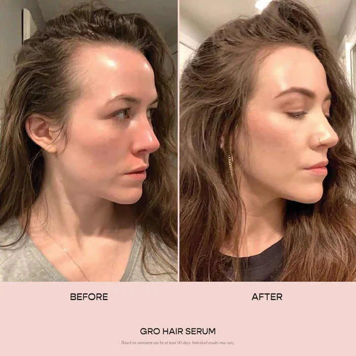 Vegamour GRO Hair Serum for Thinning Hair