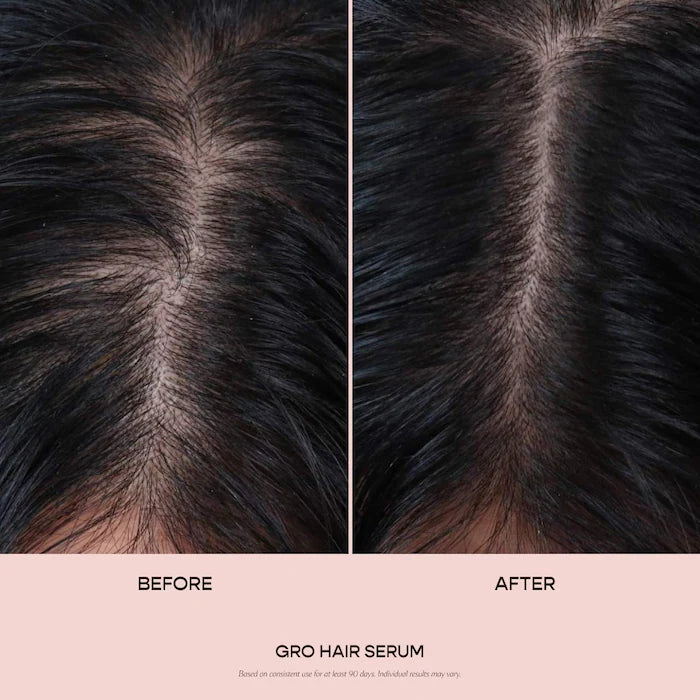 Vegamour GRO Hair Serum for Thinning Hair