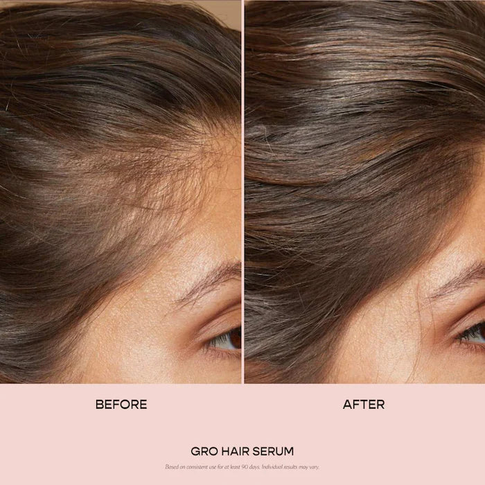 Vegamour GRO Hair Serum for Thinning Hair
