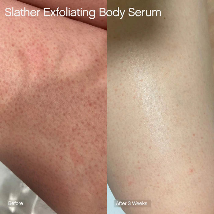 Topicals Slather Exfoliating Body Serum with Retinol and AHAs