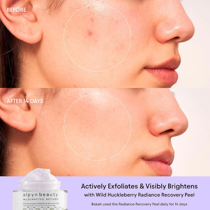 ALPYN Polishing Peel & Brightening Face Mask with 8 Acids & Huckleberry