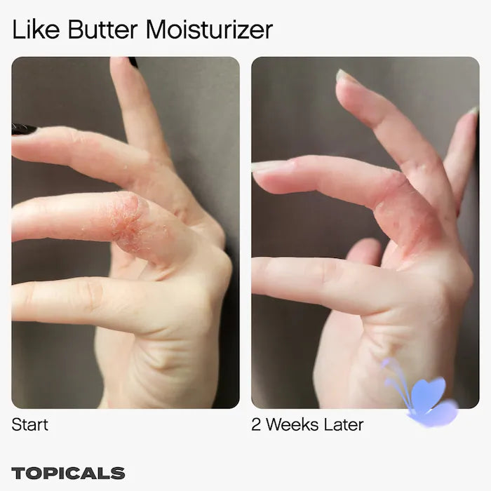 Topicals Like Butter Moisturizer for Dry, Sensitive & Eczema-Prone Skin