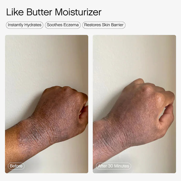 Topicals Like Butter Moisturizer for Dry, Sensitive & Eczema-Prone Skin