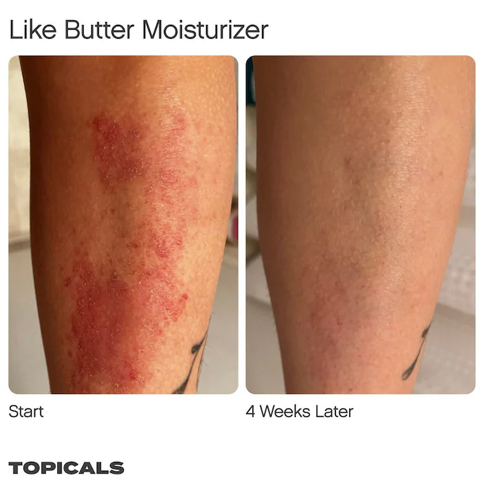 Topicals Like Butter Moisturizer for Dry, Sensitive & Eczema-Prone Skin