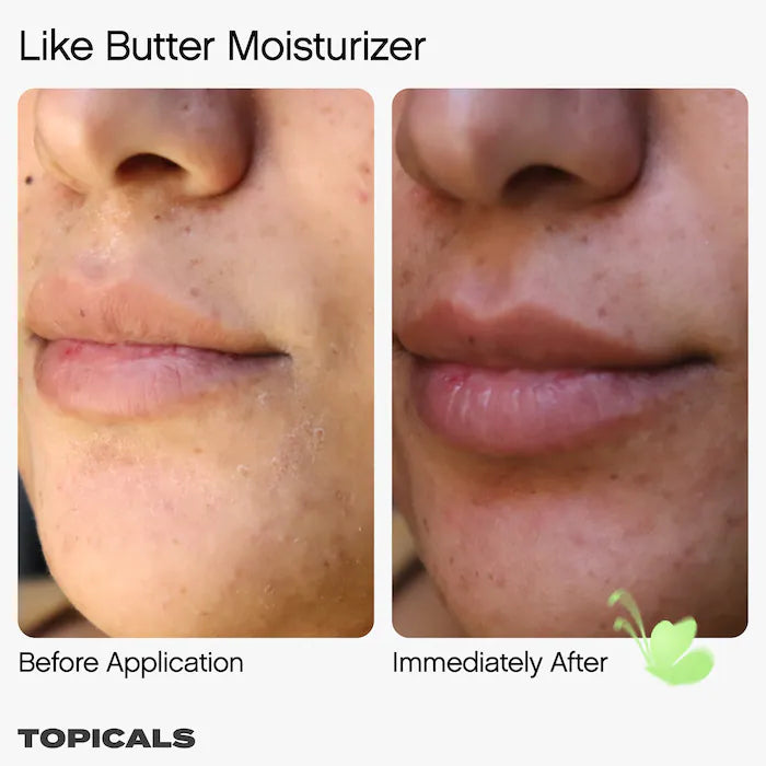 Topicals Like Butter Moisturizer for Dry, Sensitive & Eczema-Prone Skin