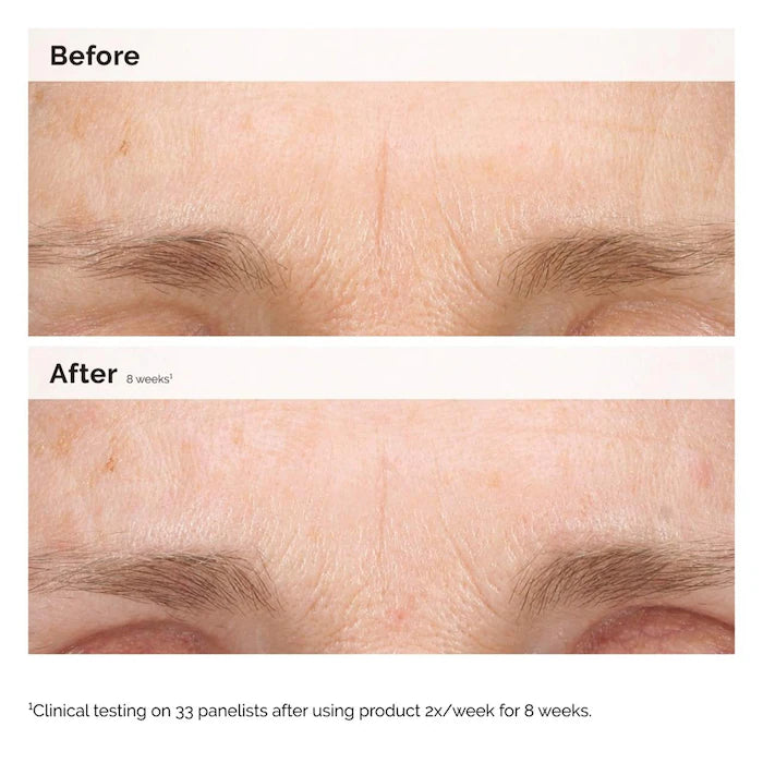 The Ordinary Retinal 0.2% Emulsion Serum