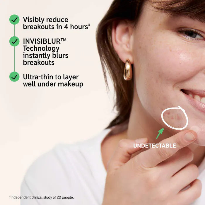 The INKEY List Hydrocolloid Invisible Pimple Patches + Salicylic Acid