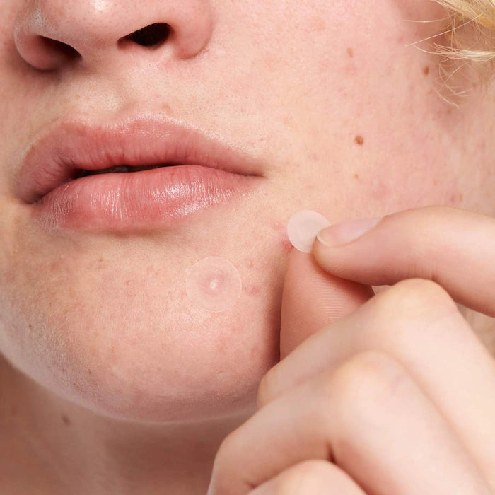 The INKEY List Hydrocolloid Invisible Pimple Patches + Salicylic Acid