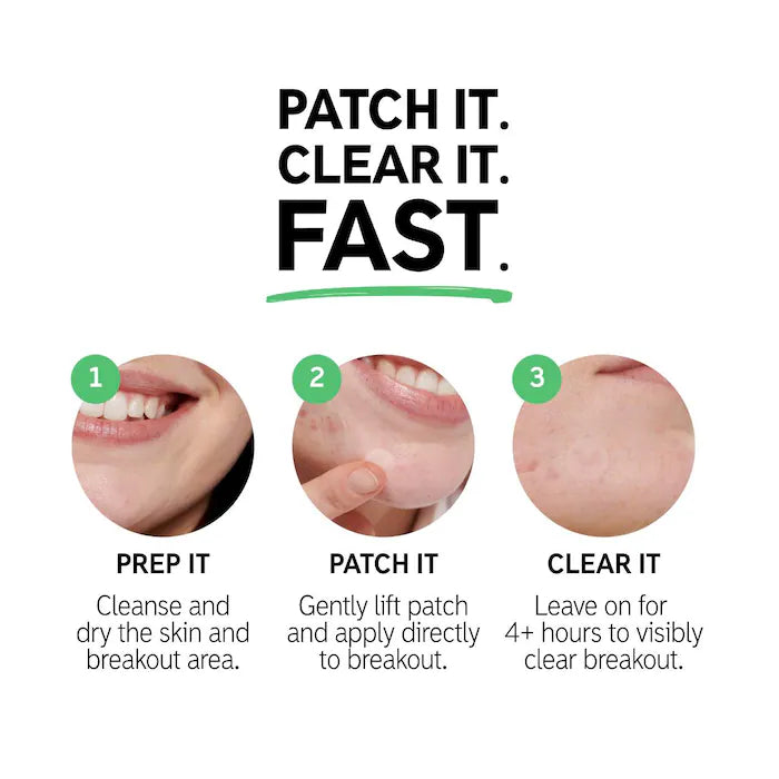 The INKEY List Hydrocolloid Invisible Pimple Patches + Salicylic Acid