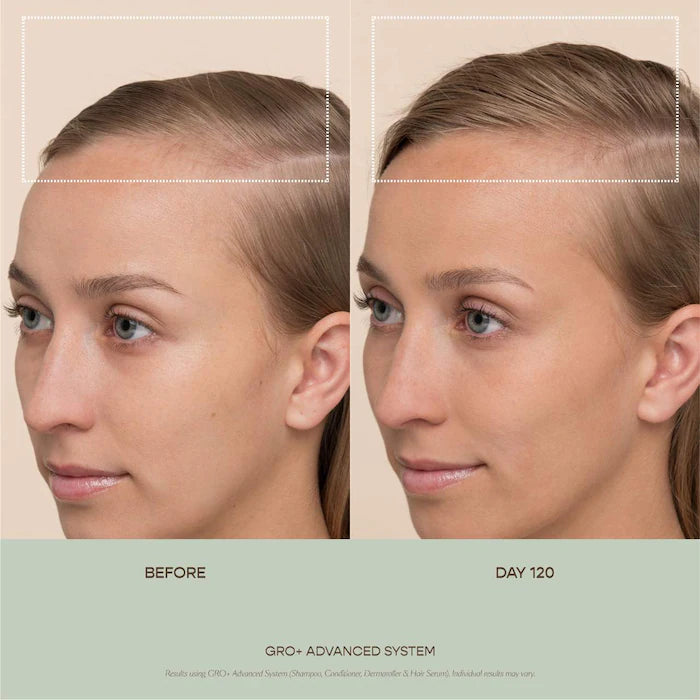Vegamour GRO+ Advanced Balancing Shampoo and Conditioner Set for Severe Signs of Thinning