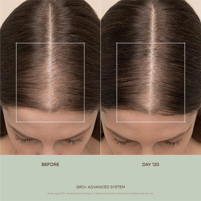 Vegamour GRO+ Advanced Balancing Shampoo and Conditioner Set for Severe Signs of Thinning