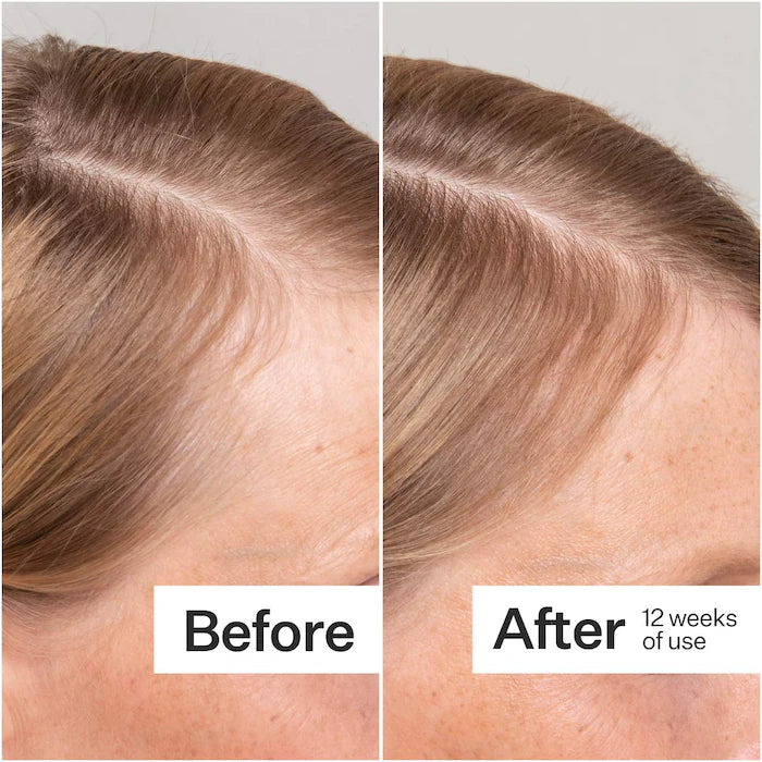 Act+Acre 2% Stem Cell H-2 Grow Complex ™ Scalp Serum For Thicker-Looking Hair