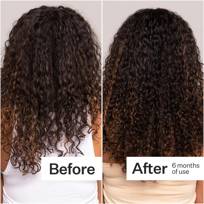 Act+Acre 2% Stem Cell H-2 Grow Complex ™ Scalp Serum For Thicker-Looking Hair