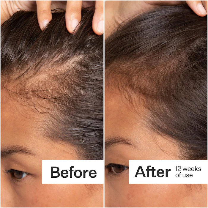 Act+Acre 2% Stem Cell H-2 Grow Complex ™ Scalp Serum For Thicker-Looking Hair