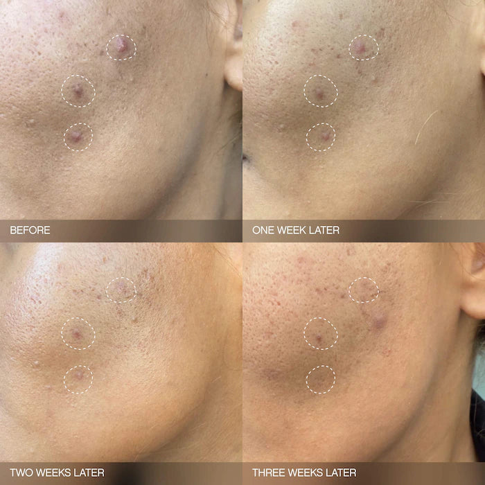 Topicals Mini Faded Brightening and Clearing Serum for Dark Spots & Discoloration (UNSCENTED)