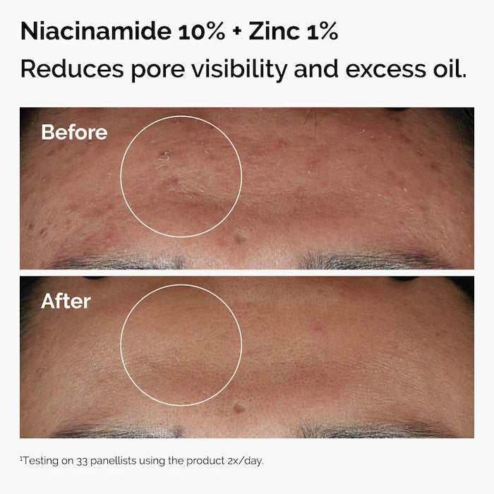 The Ordinary The Skin Support Set with Niacinamide + Hyaluronic Acid