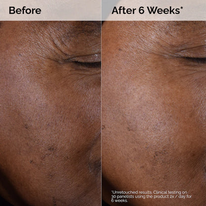 The Ordinary  Glycolic Acid 7% Exfoliating Toner