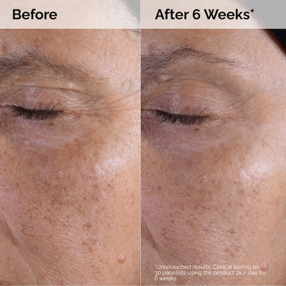 The Ordinary  Glycolic Acid 7% Exfoliating Toner