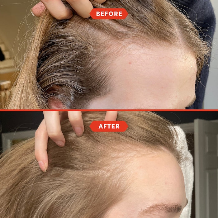 Fable & Mane  HoliRoots™ Pre-Wash Scalp & Hair Treatment Oil