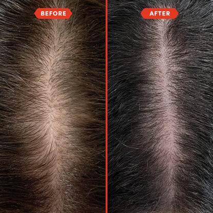 Fable & Mane  HoliRoots™ Pre-Wash Scalp & Hair Treatment Oil