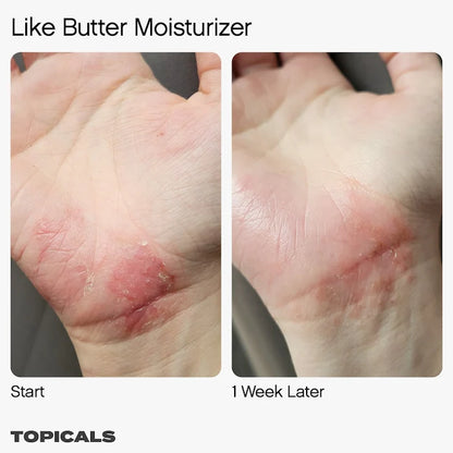 Topicals  Like Butter Moisturizer for Dry, Sensitive & Eczema-Prone Skin