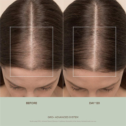 Vegamour  GRO+ Advanced Balancing Shampoo and Conditioner Set for Severe Signs of Thinning