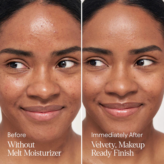 ALPYN  Melt Moisturizer for Firming, Plumping & Brightening
