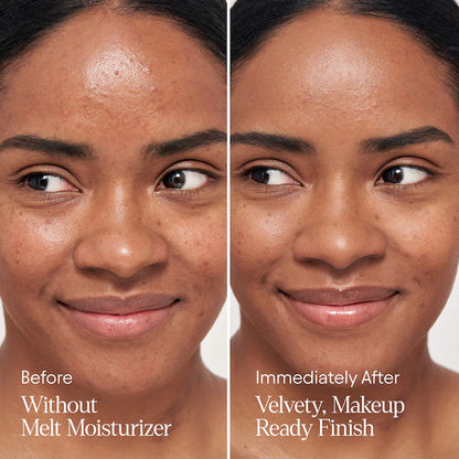 ALPYN  Melt Moisturizer for Firming, Plumping & Brightening