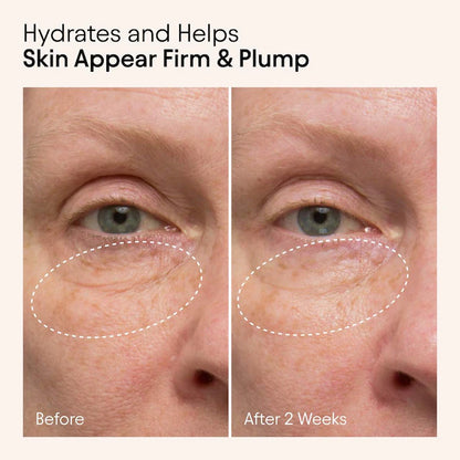 ALPYN  Hydrating Firming Serum with Niacinamide & Nettle