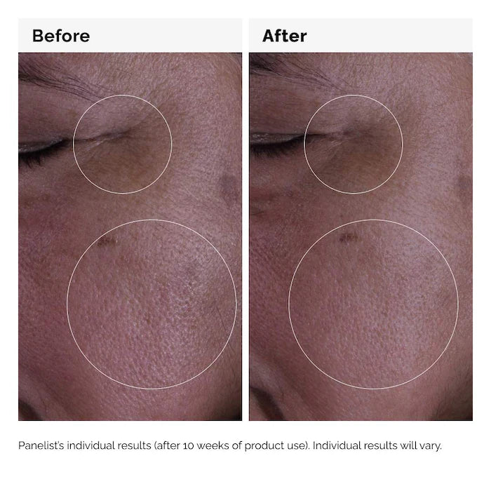 The Ordinary  GF 15% Serum for Visible Skin Repair and Wrinkles