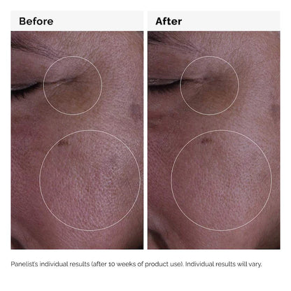 The Ordinary  GF 15% Serum for Visible Skin Repair and Wrinkles