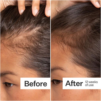 Act+Acre  2% Stem Cell H-2 Grow Complex ™ Scalp Serum For Thicker-Looking Hair