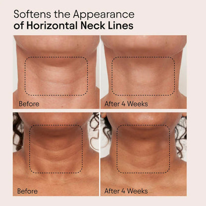 ALPYN  Super Sculpt Serum For Face & Neck with Tri-Peptide Firming Complex