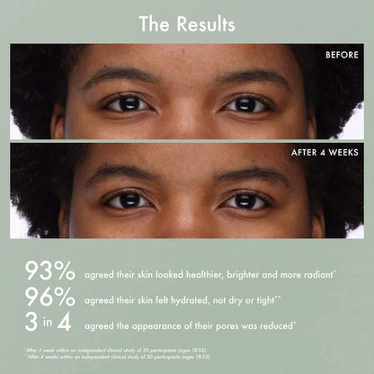 Summer Fridays  Gentle Reset Daily Exfoliating Pads to Smooth + Minimize Pores with AHAs